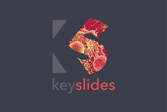 KEY SLIDES